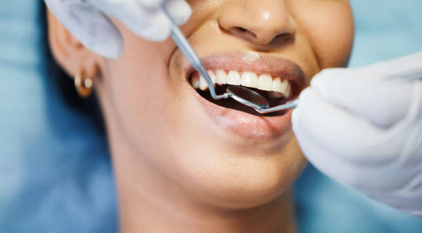 Best Same-Day Emergency Dental Services in New Knoxville, OH